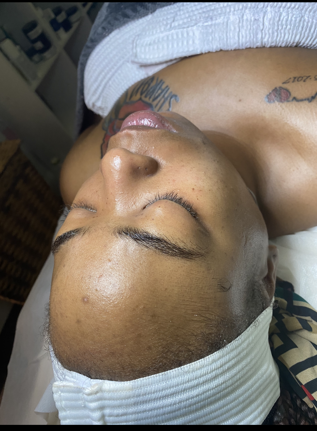 Diamond Tip Dermabrasian