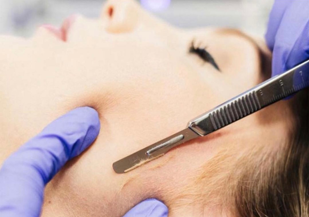 Dermaplane Facial