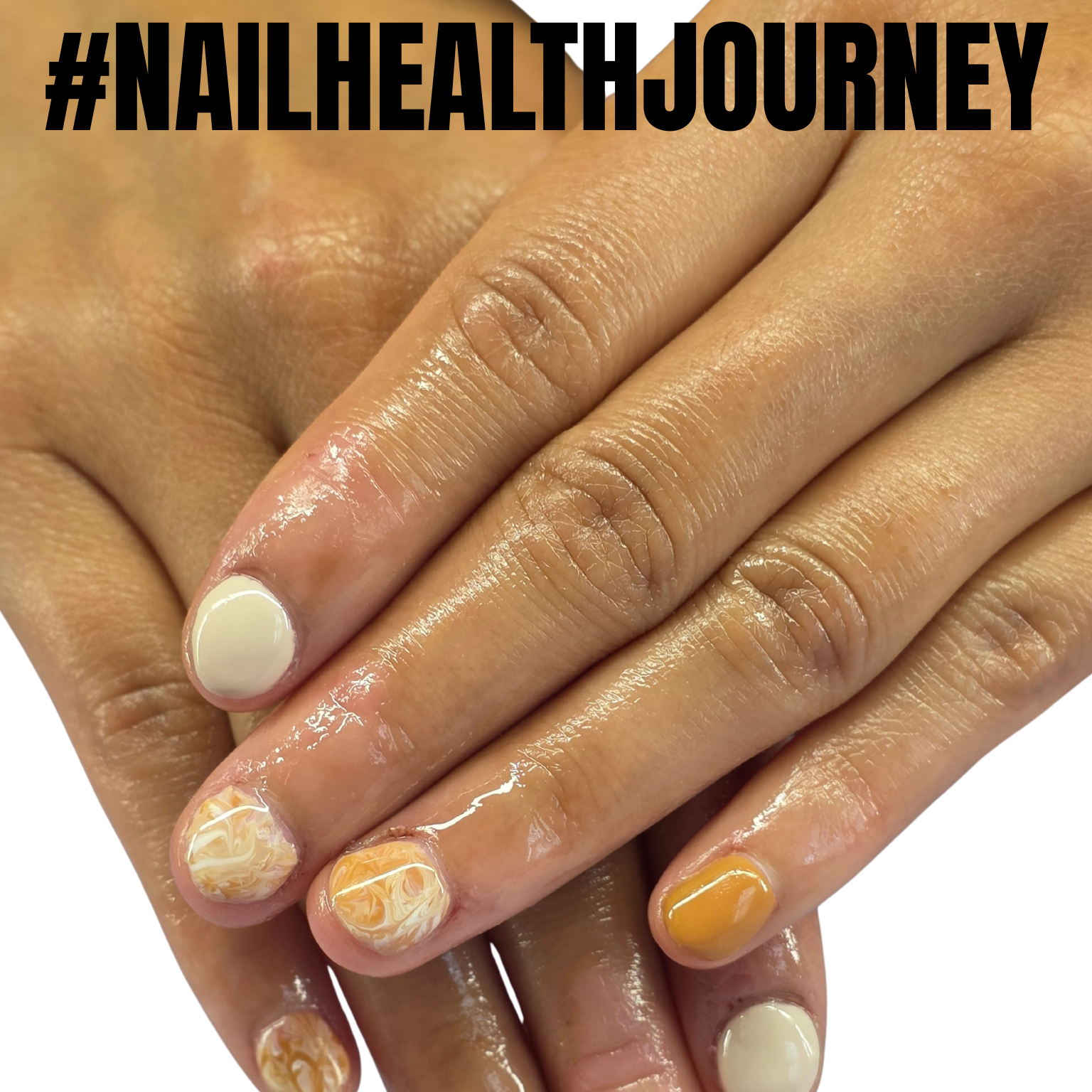 Soak offs / Removidos