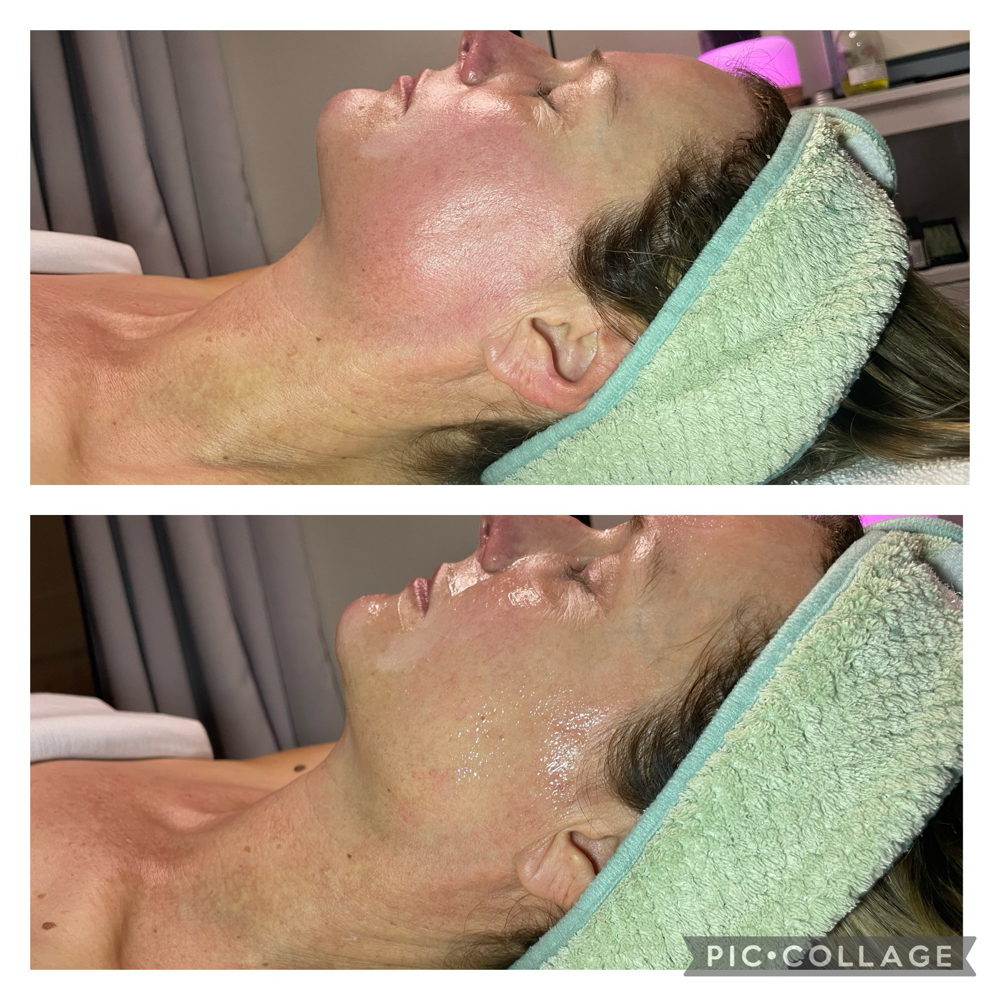 Signature Facelift Facial