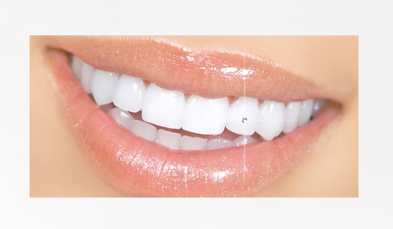 Tooth Gem