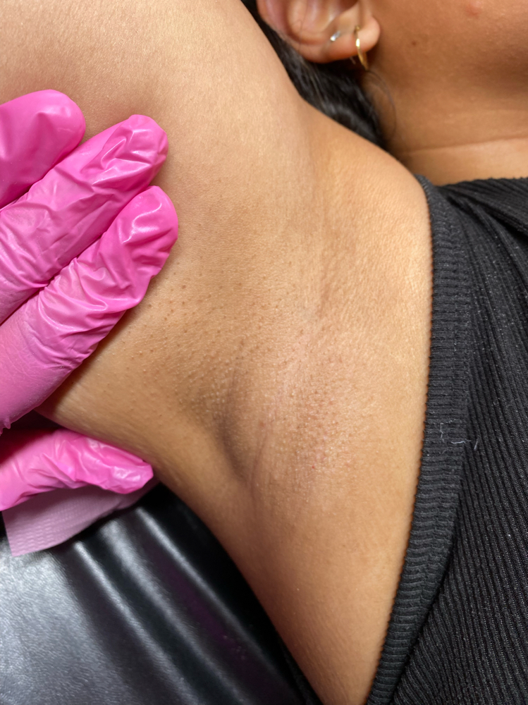 Underarm Wax
