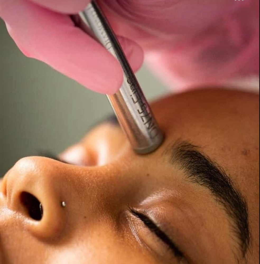 Microdermabrasion Facial Treatement