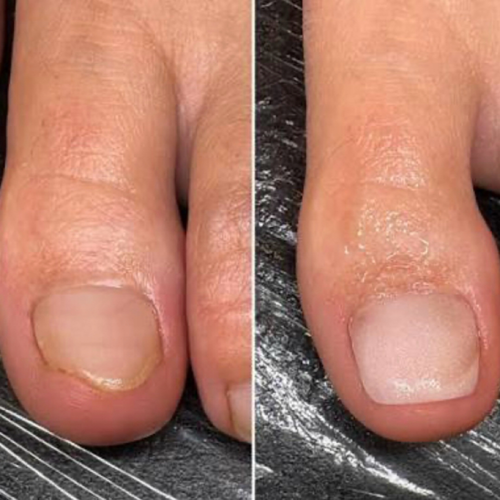 Acrylic Toe Nail Repair ($5-$15) at Divina Nail Lounge in Round Rock, TX