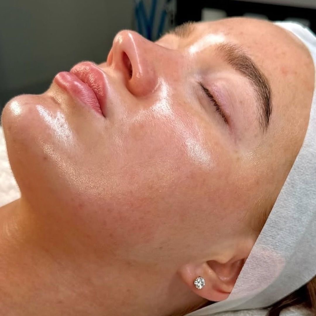 BRIGHT SKIN at Remake Beauty Studio San Juan in San Juan, TX