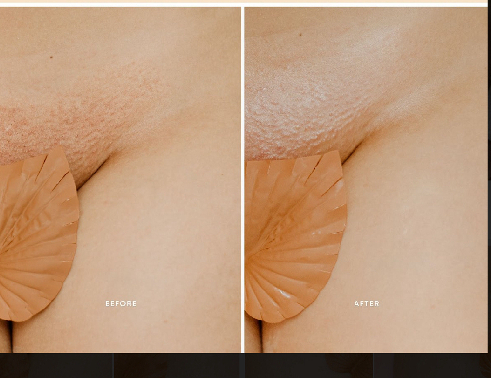 Female Brazilian + Deluxe Vagacial