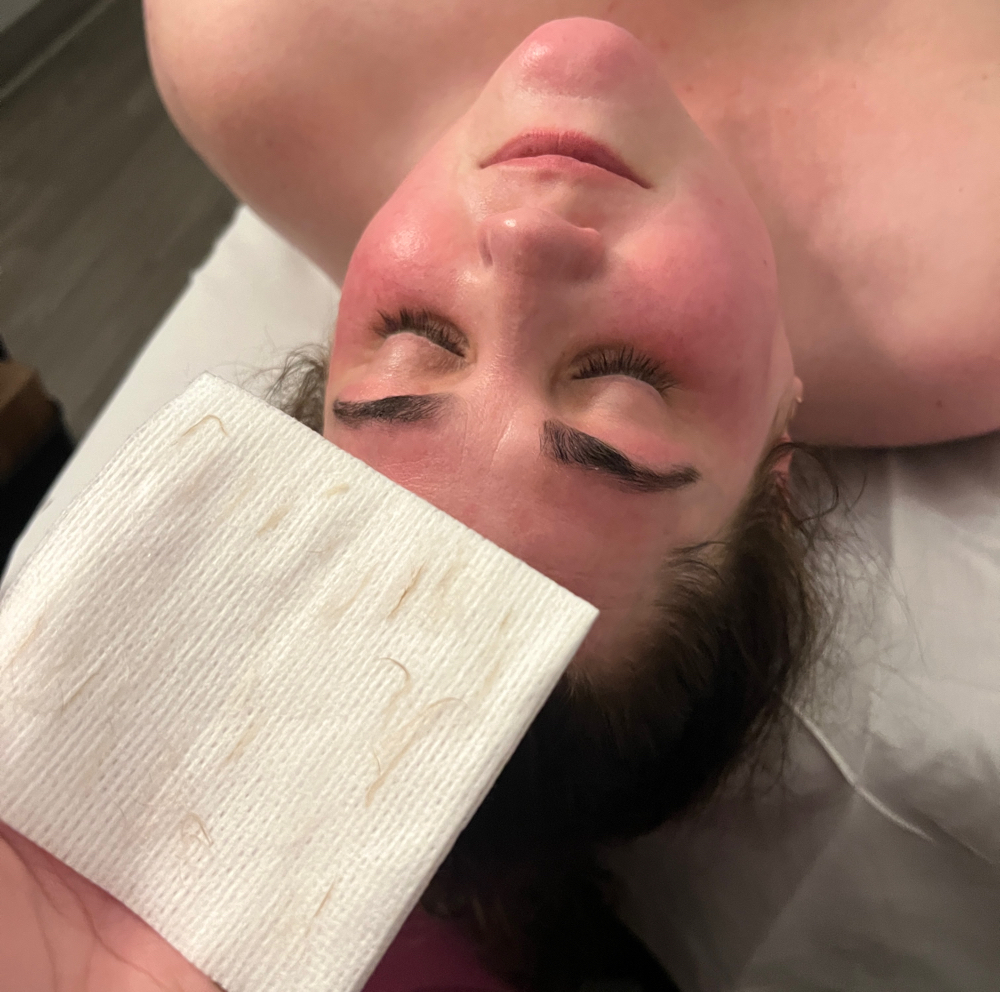 DERMAPLANE FACIAL