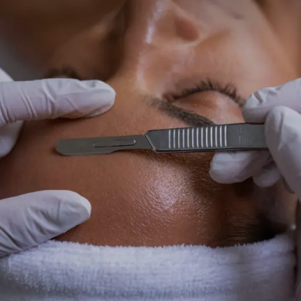 Dermaplane Only Facial at Dreamland Health and Wellness in Indianapolis, IN
