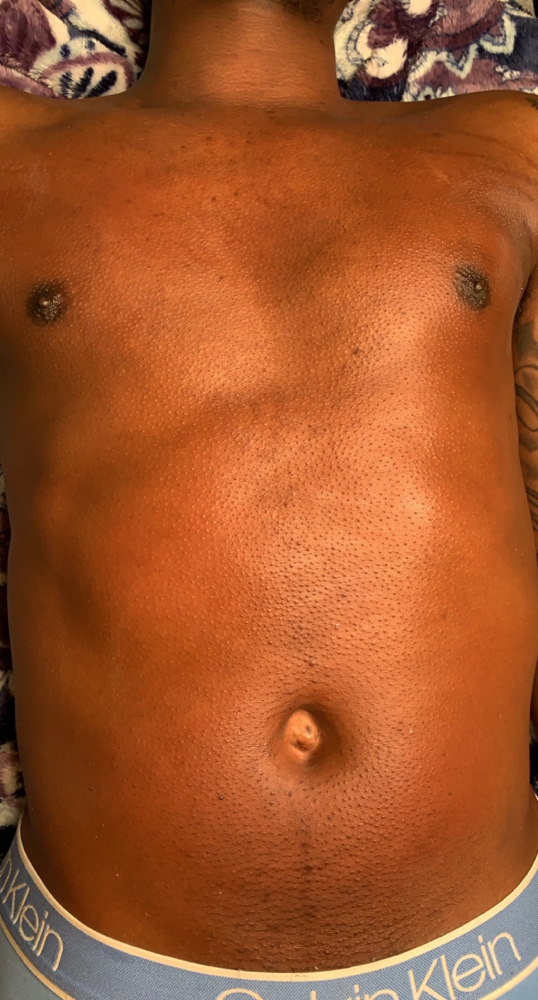 Chest Wax