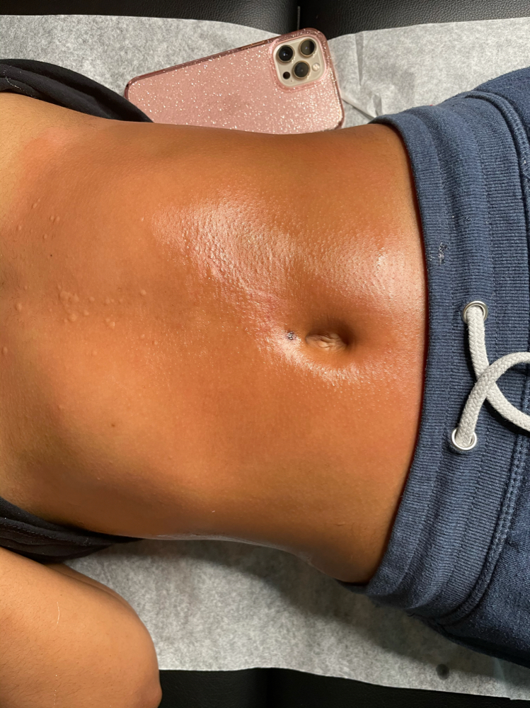 Stomach Waxing