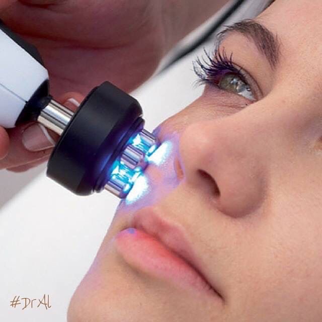 Radio Frequency Facial