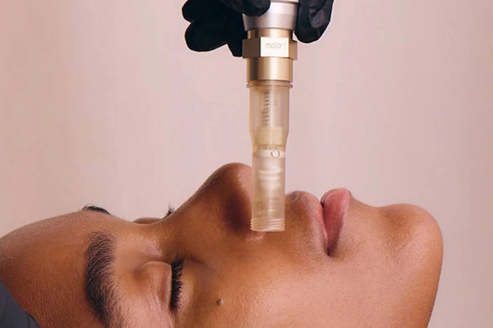 Nano Needling Facial Add-On