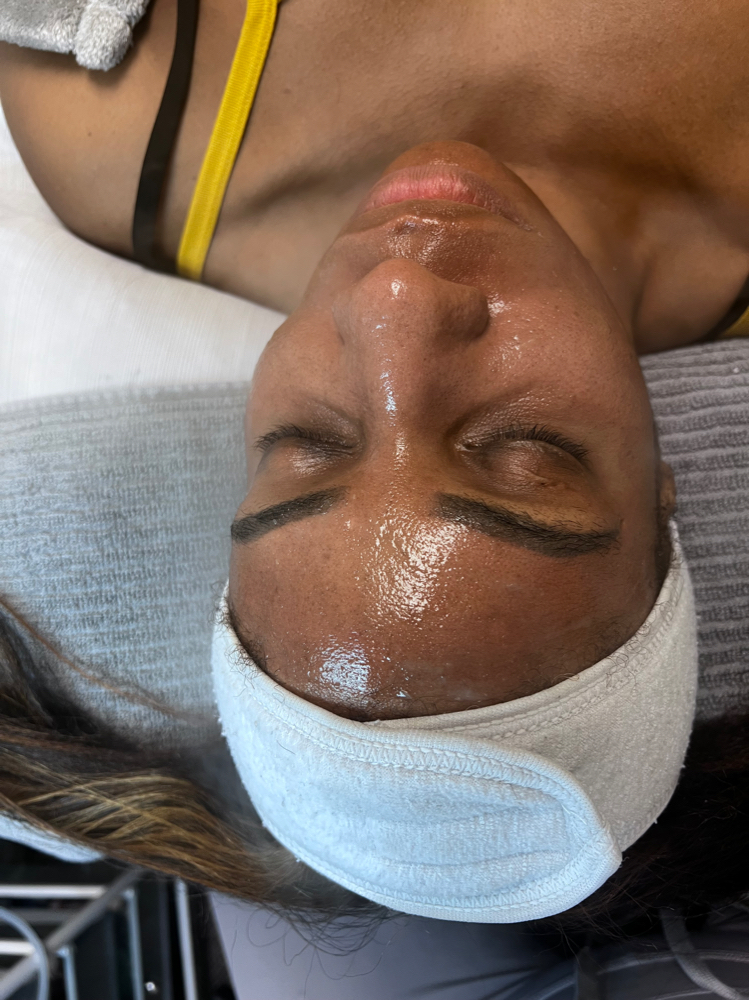 ROA Custmized Facial