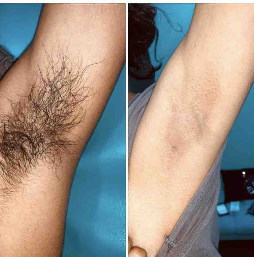 Under Arm Waxing at Bare Expectations Mobile Waxing in Webster, TX