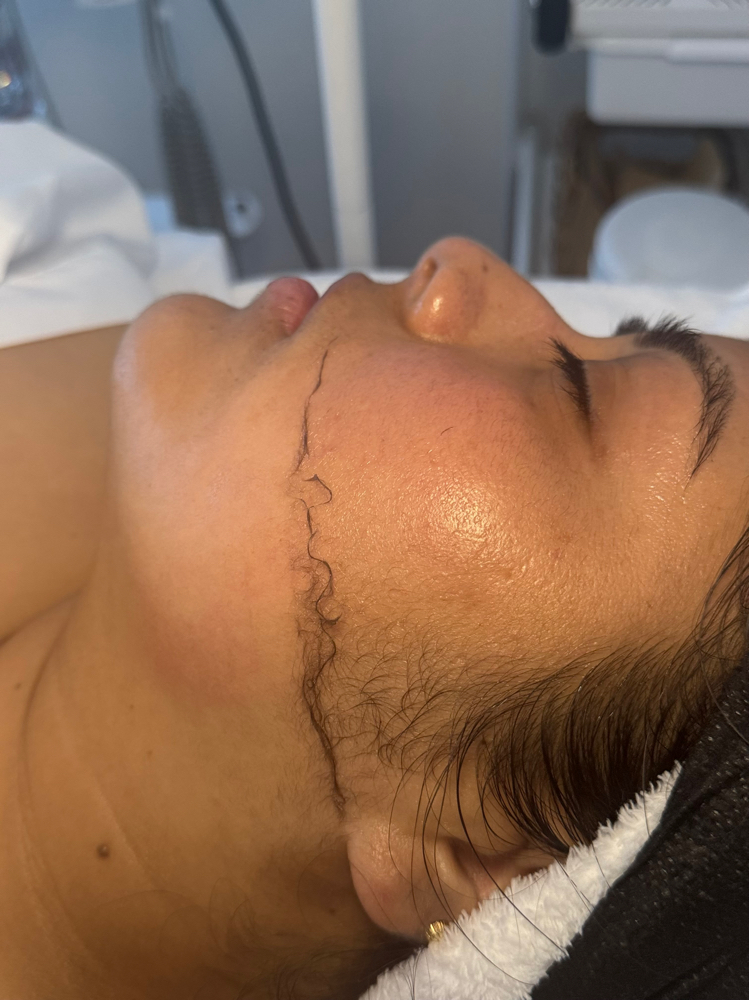 Dermaluxe Facial