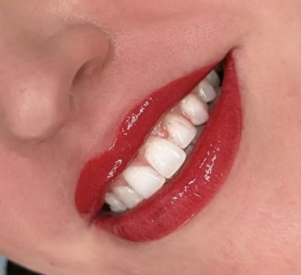 Lip Blushing