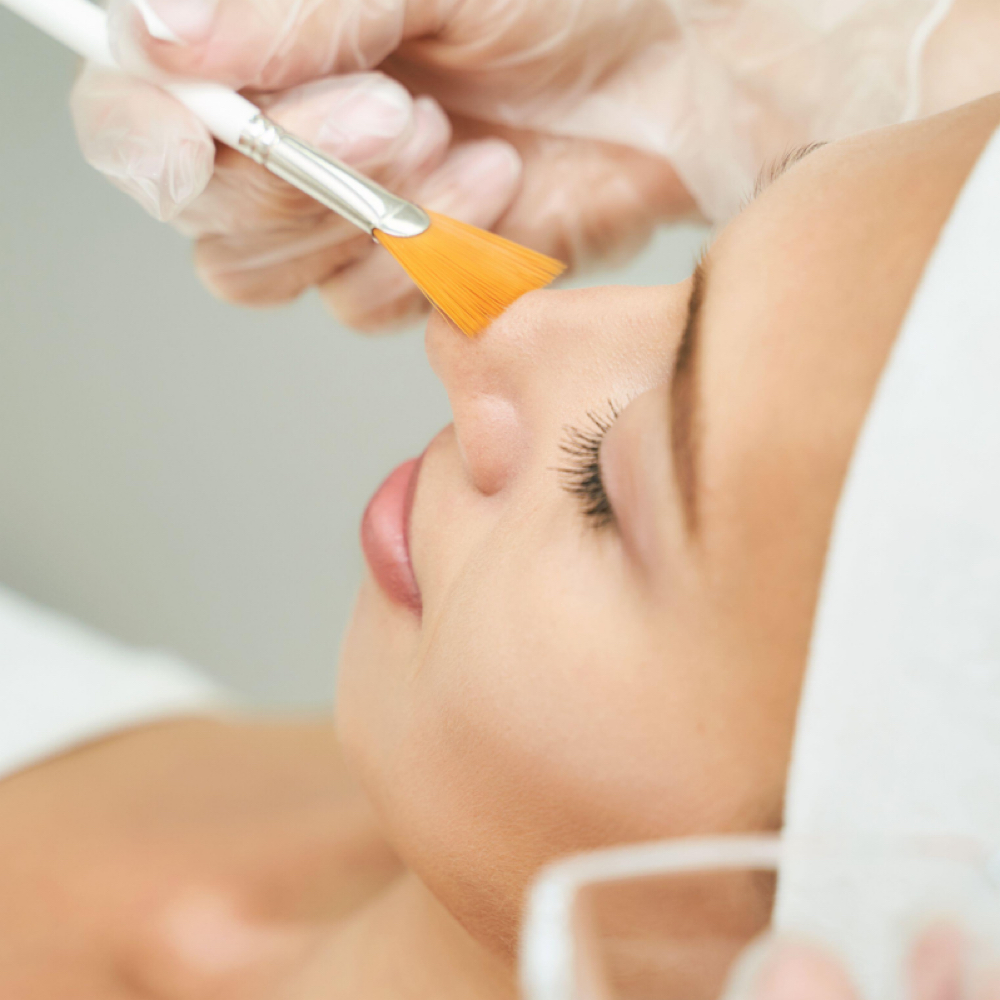 Chemical Peel at AZ Brows & Skin in Scottsdale, AZ
