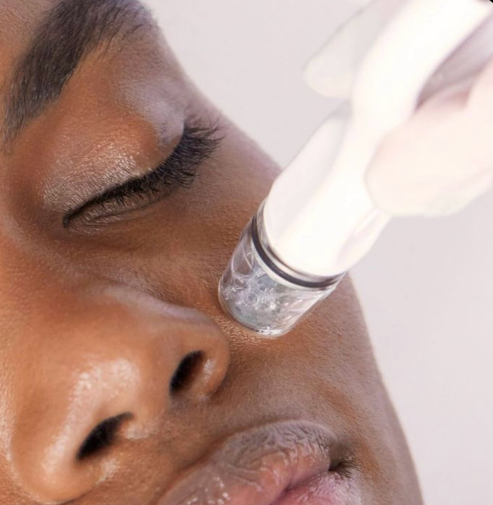 Signature Hydrodiamond Facial at Skin Tender in Ventura, CA
