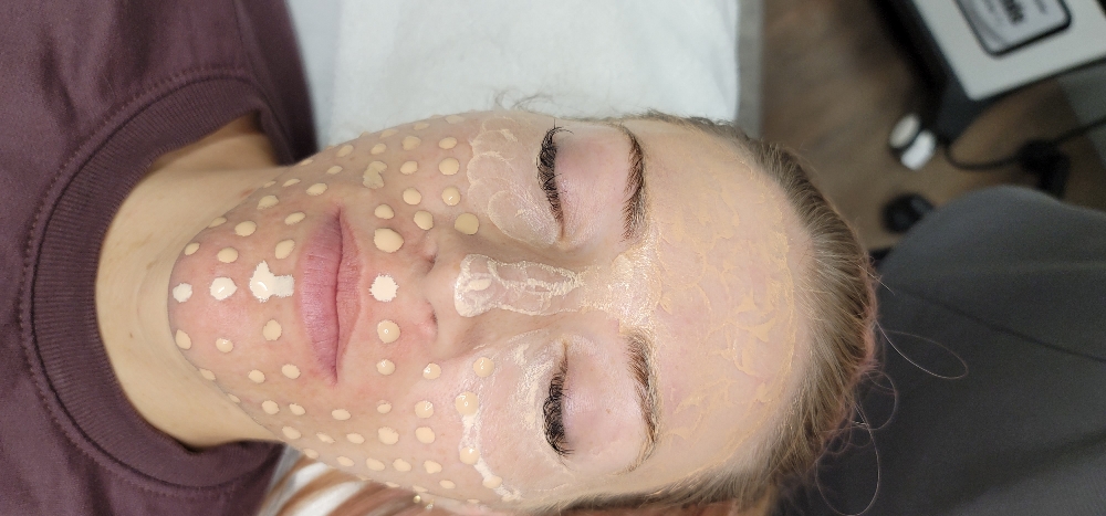 BB Glo Facial
