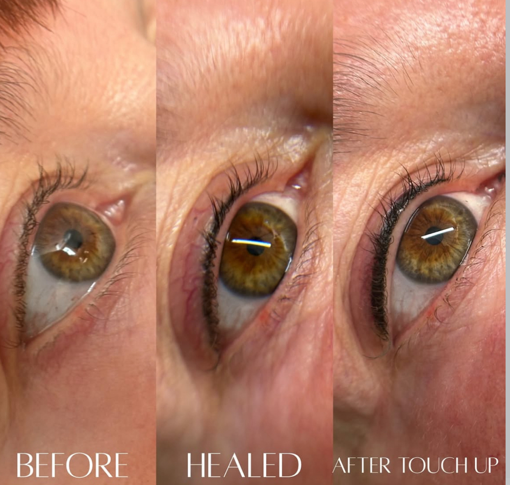 Eyeliner 10-12 week follow up