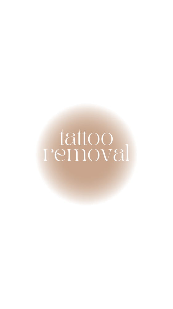 Tattoo Removal