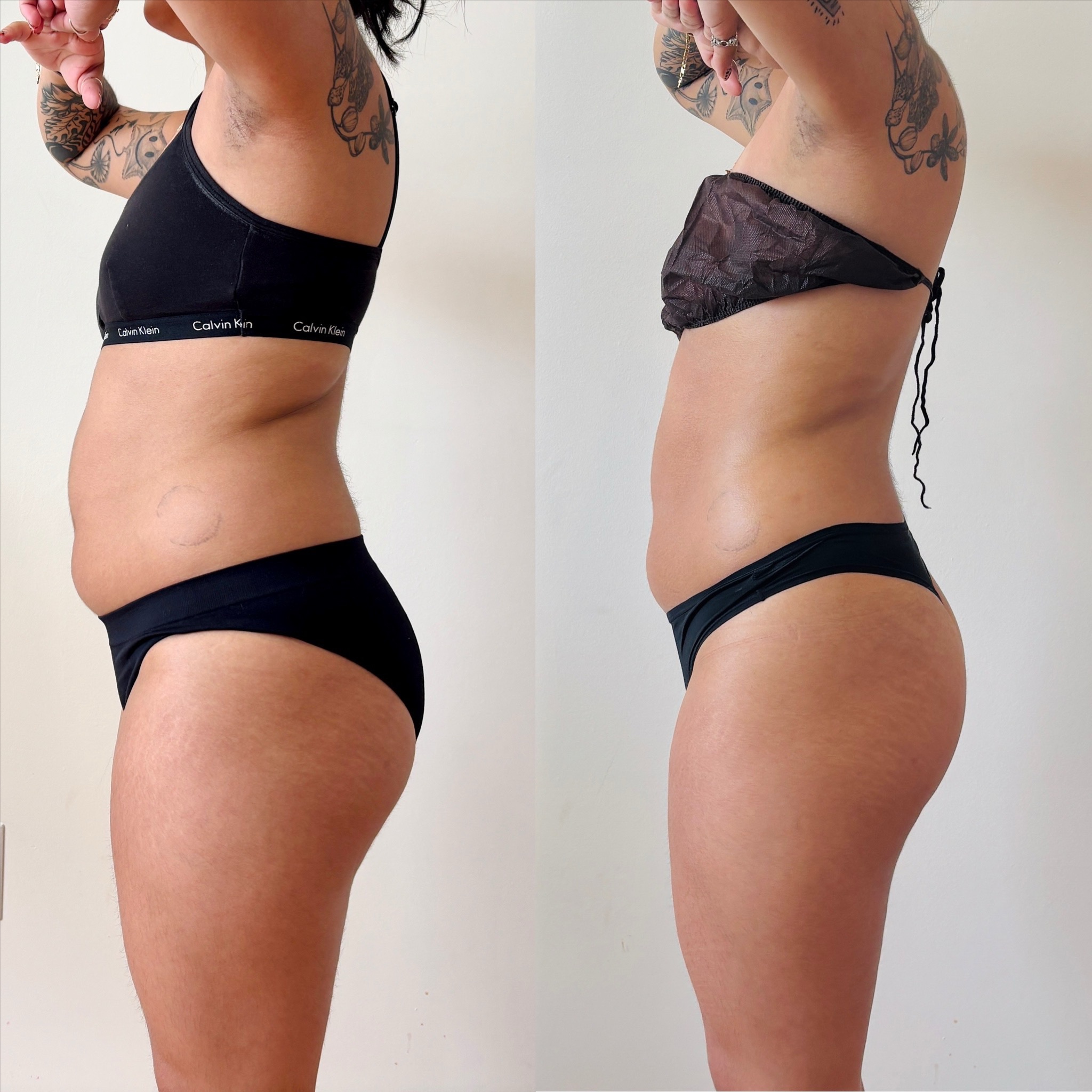 BareFruit Lymphatic Reset at BareFruit Body Lab in Alexandria, VA