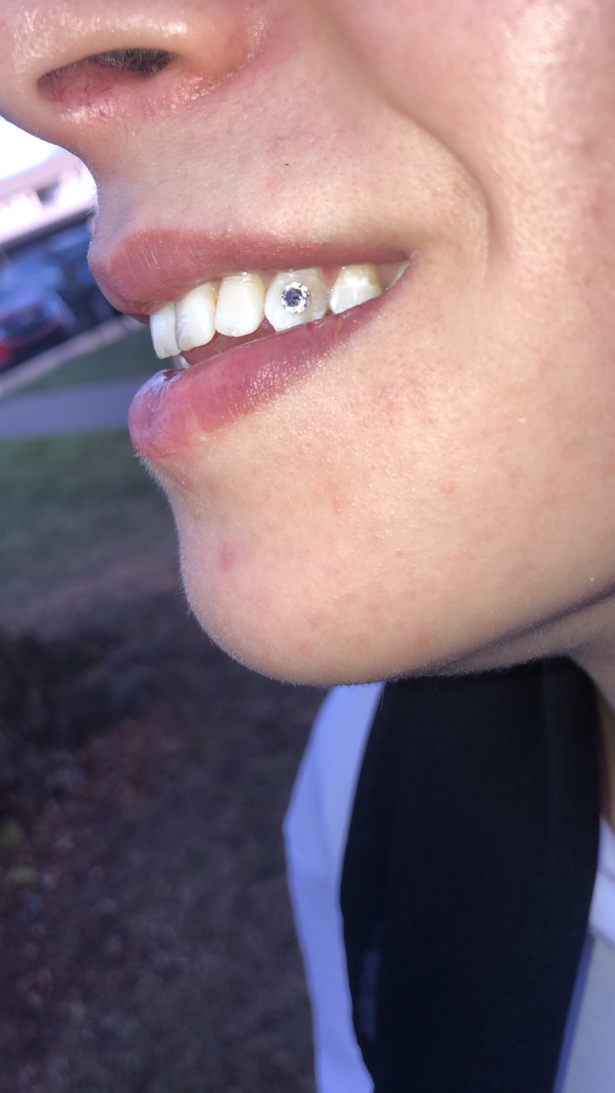 Tooth Gems