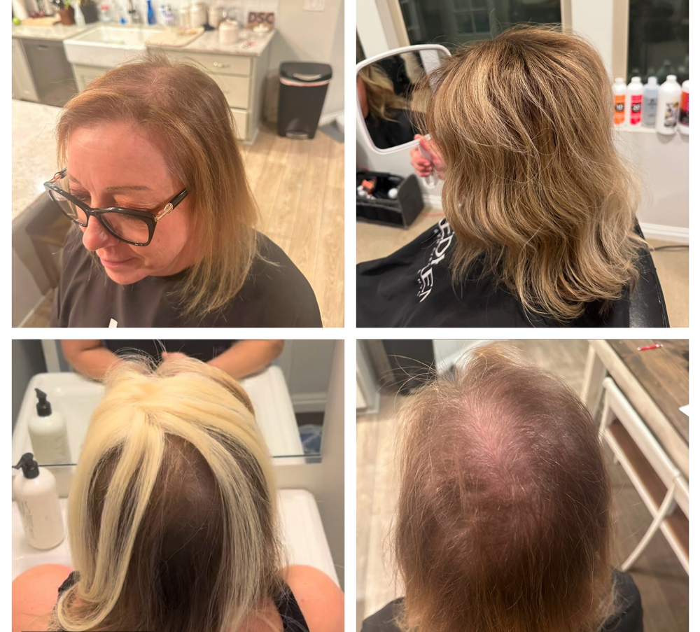 Human Hair Topper Consultstion
