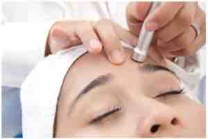 Microdermabrasion Treatment