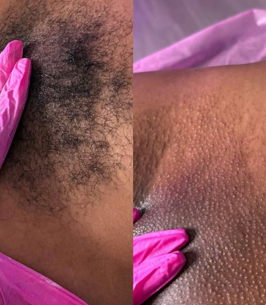 Brazilian Wax