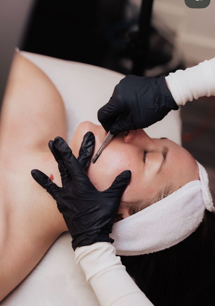 Dermaplaning Facial at Espy Esthetics in Midland, TX