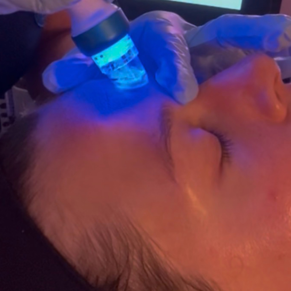Hydrafacial Deluxe at Bonita L-esthetics in San Antonio, TX