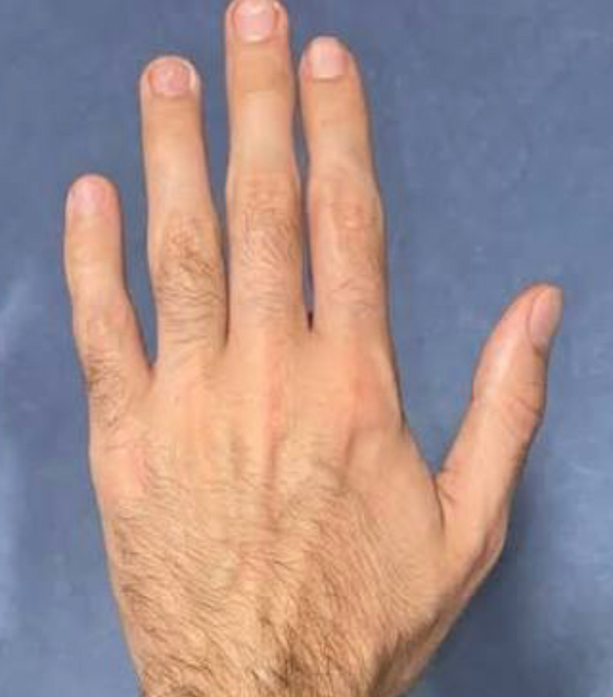 Hands