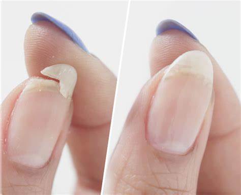 NAIL FIX