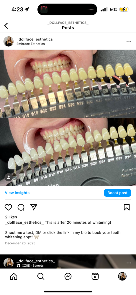 Teeth Whitening 10mins