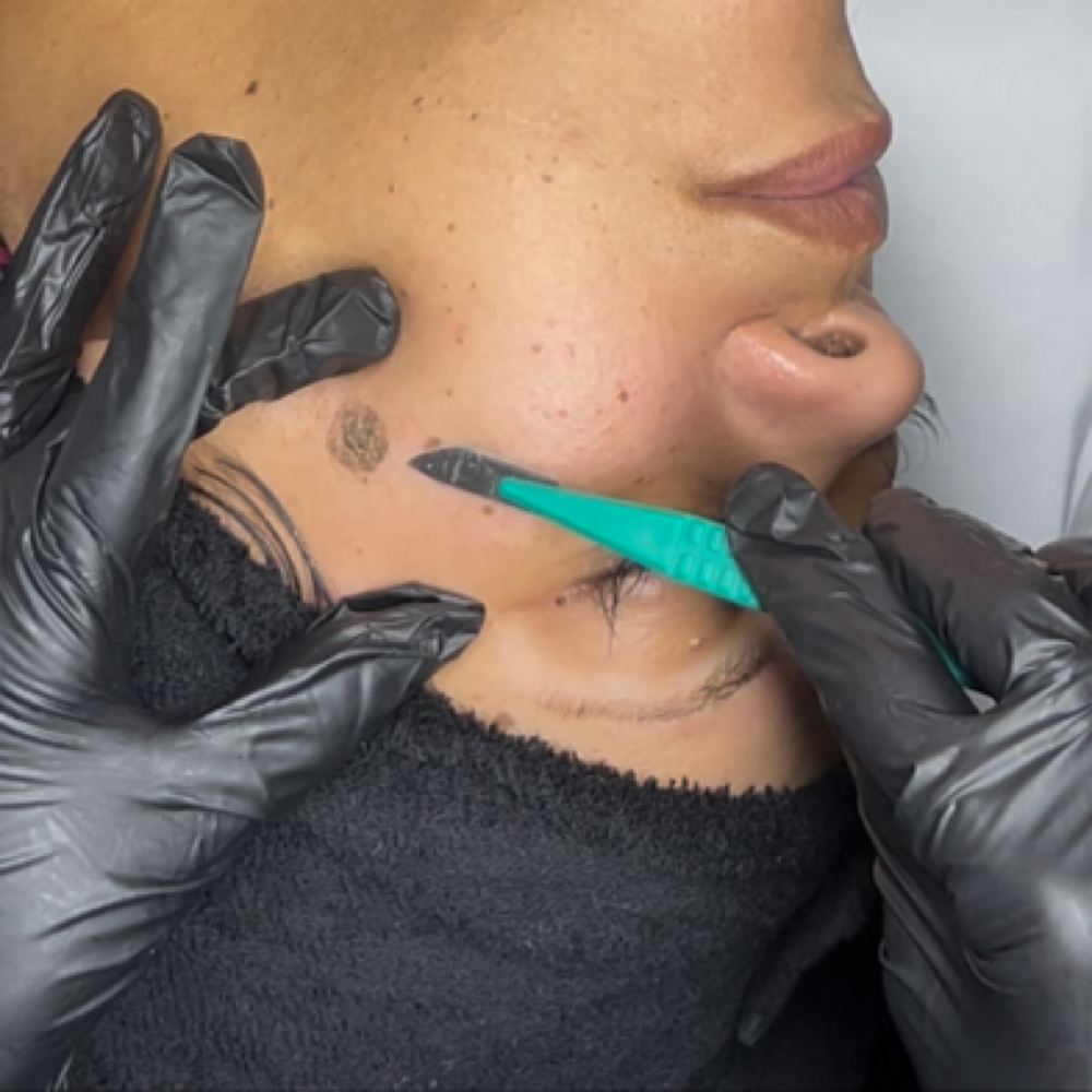 Dermaplaning at LuxurybyLarella in Houston, TX