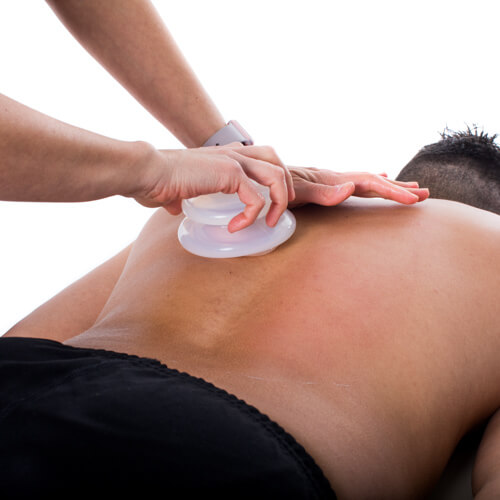 75min Cupping Massage