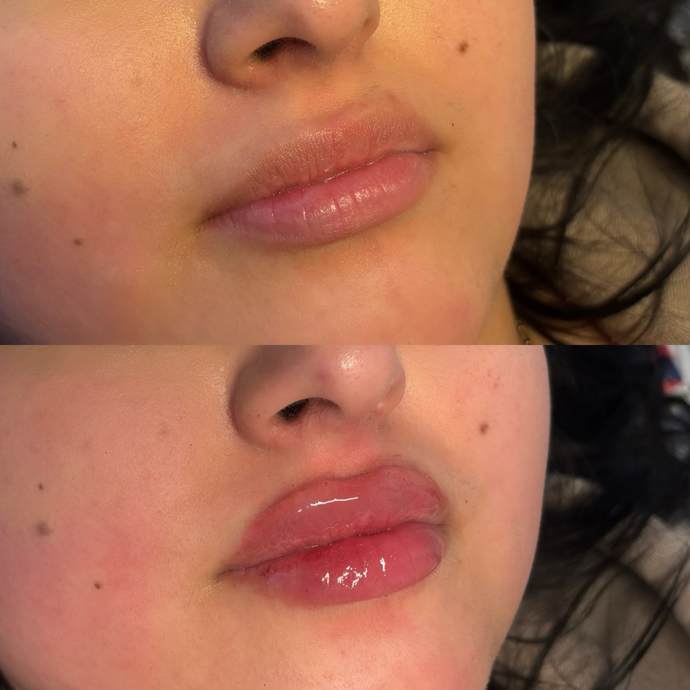 0.5ml Nano at Bodiedcosmeticss in Joliet, IL