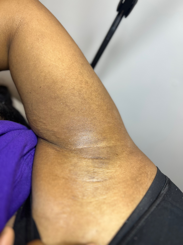 Under Arm Wax