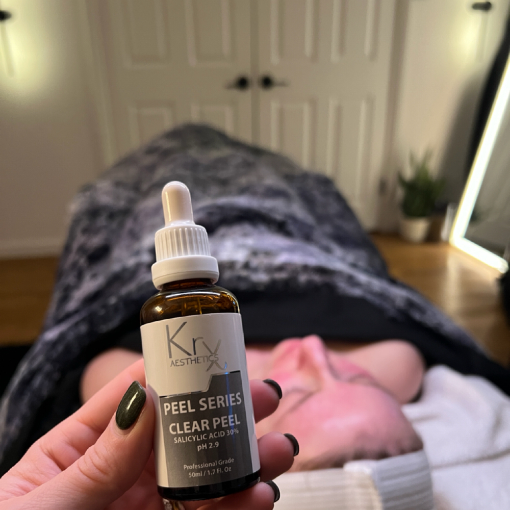 Kyss Chemical Peels at Kyss Skin Studio in Cortlandt, NY