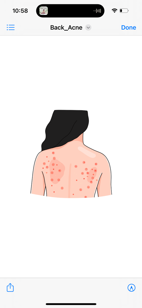 Back Treatment