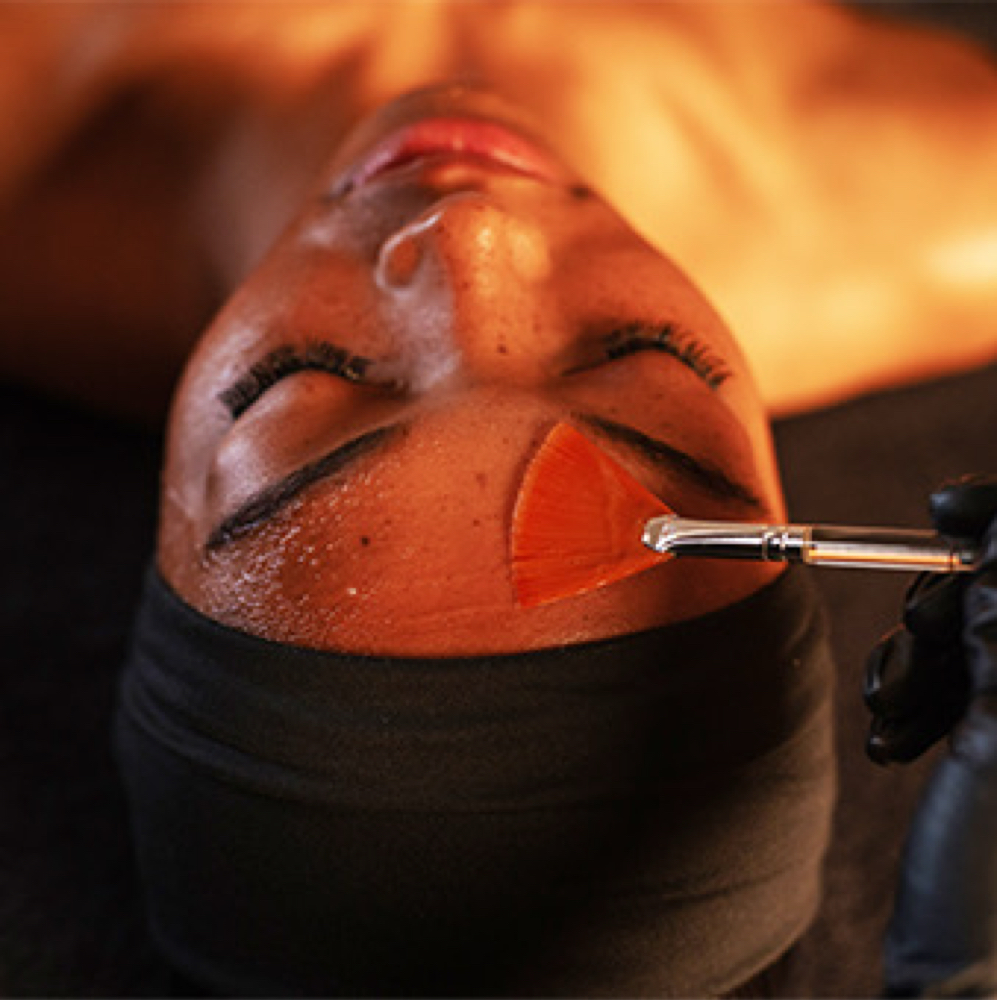 Vitamin C Radiance Renewal Facial at Skin Deep Esthetics in Mentor, OH