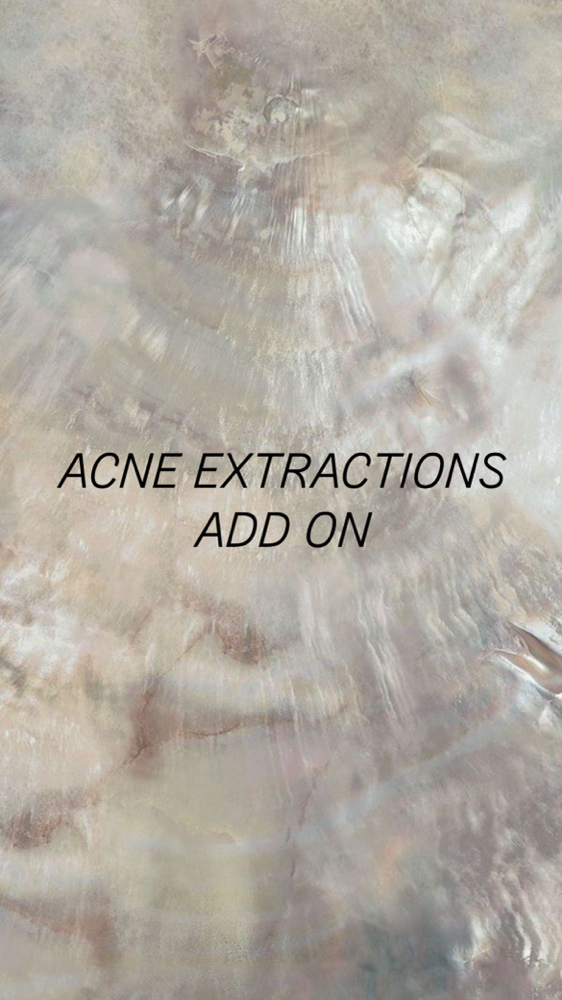Acne Extractions ADD ON