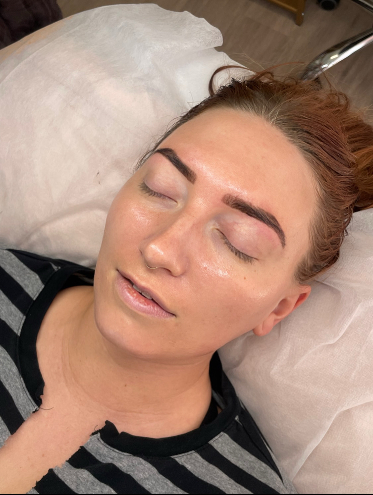 Rapid Radiance Dermaplaning