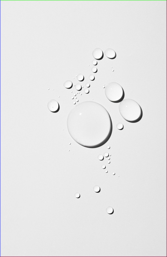 30% Lactic Acid Chemical Peel