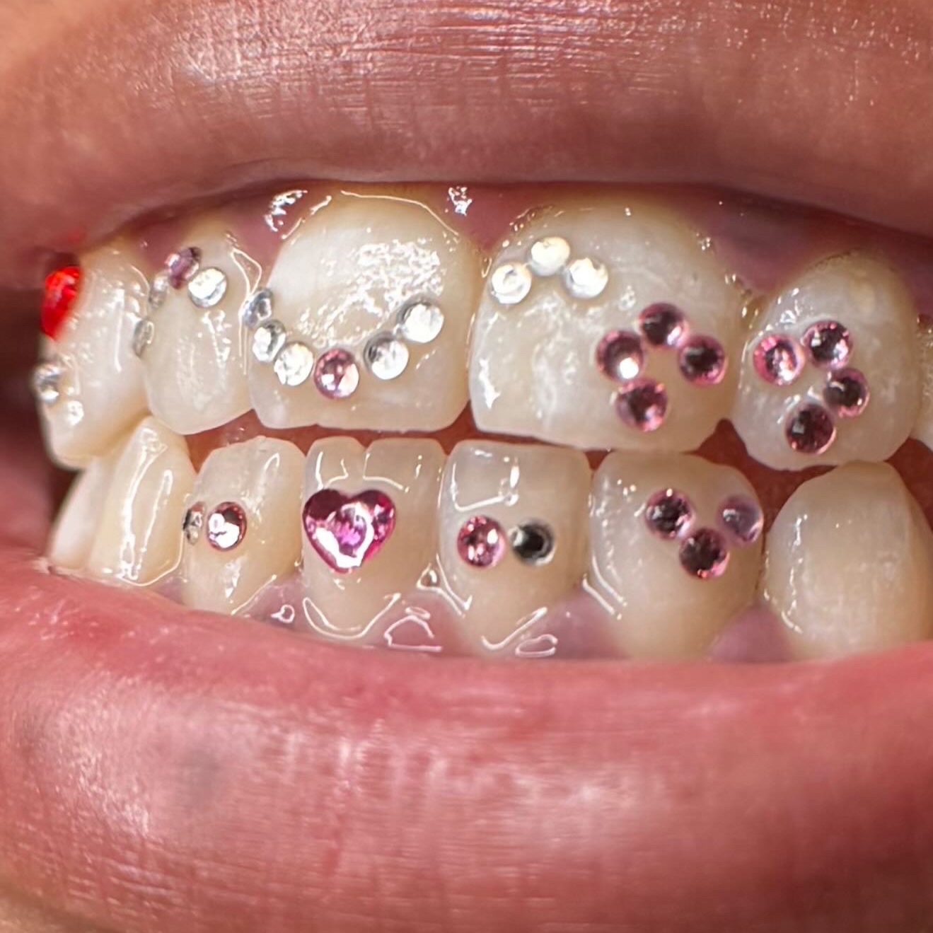 Freestyle at Smiles By Ali✨ in Arlington, TX