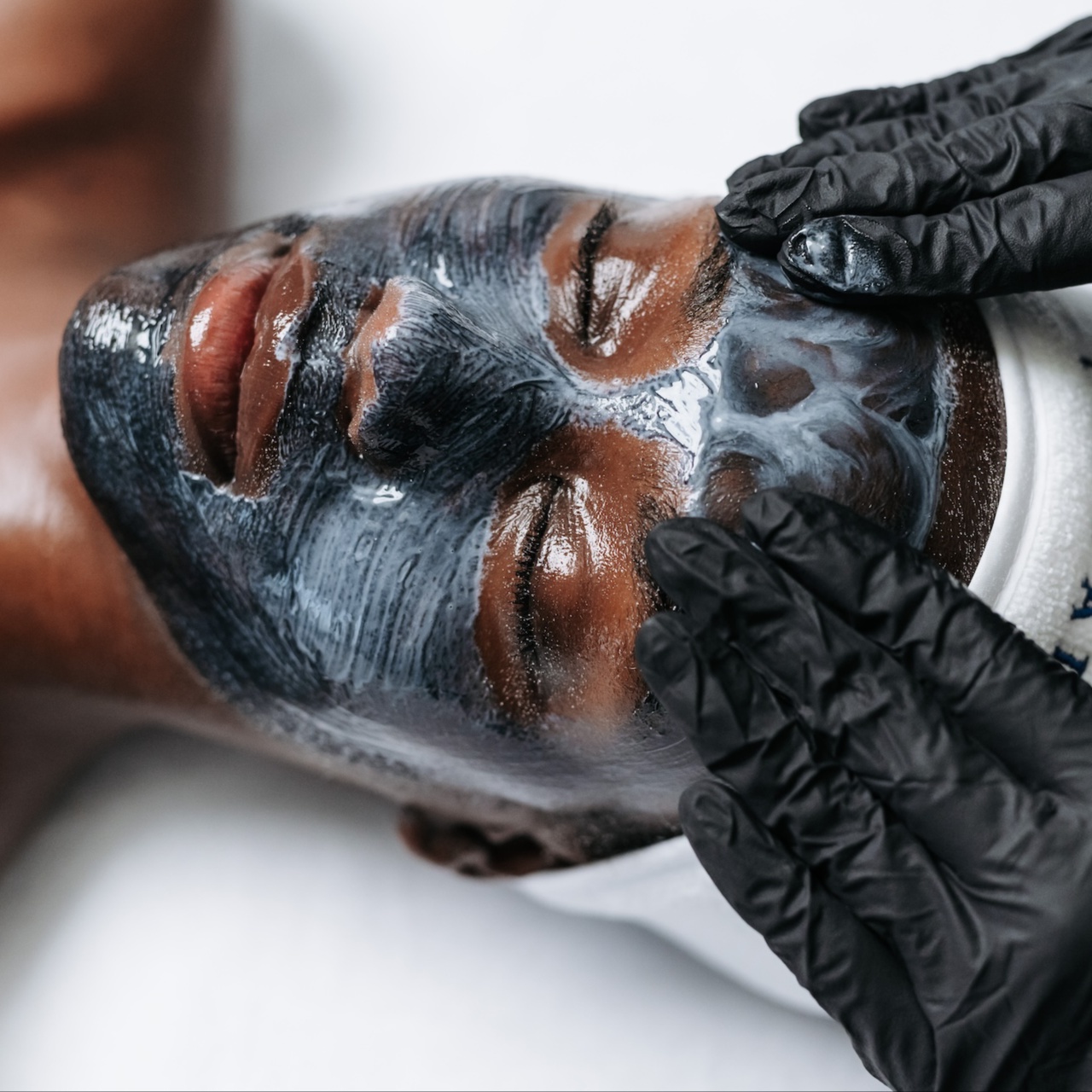 Acne Repair Treatment at SUSH Skin Studio And Spa in Covington, WA