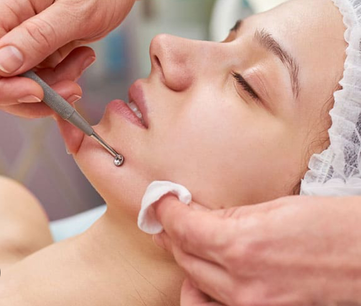 Deep Facial With Microdermabrasion