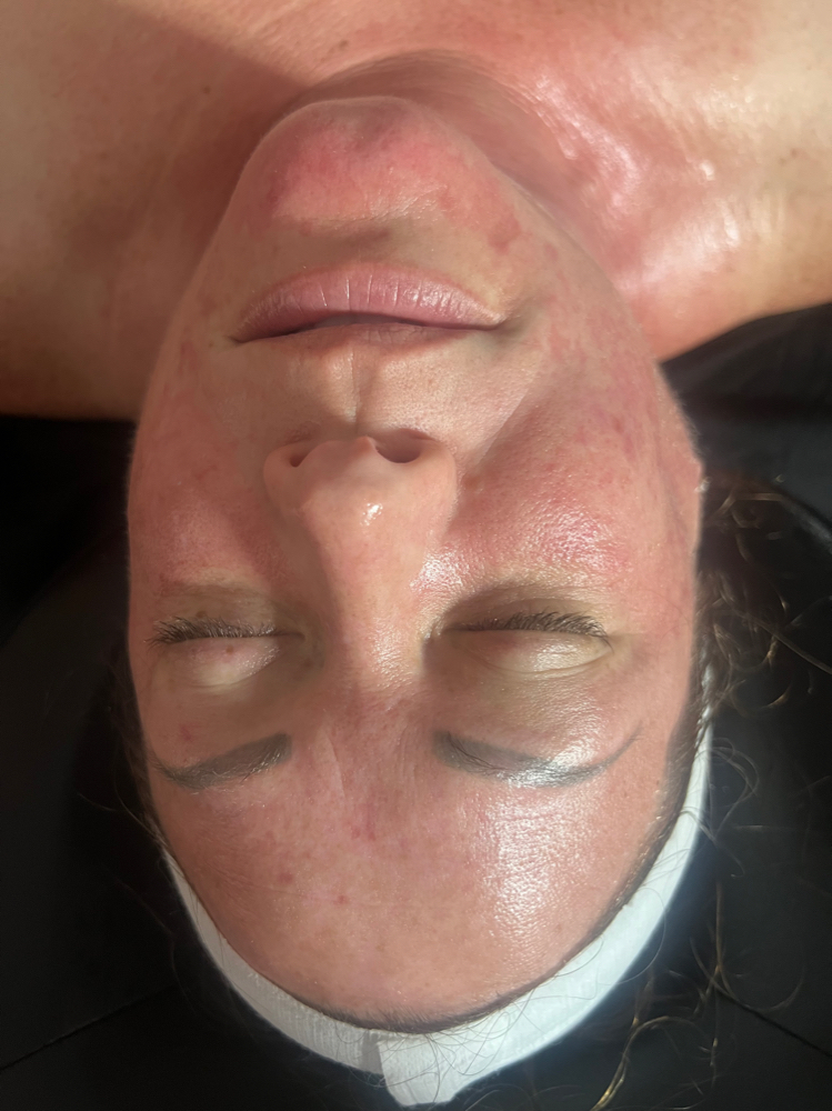 Dual Exfoliation Peel Facial