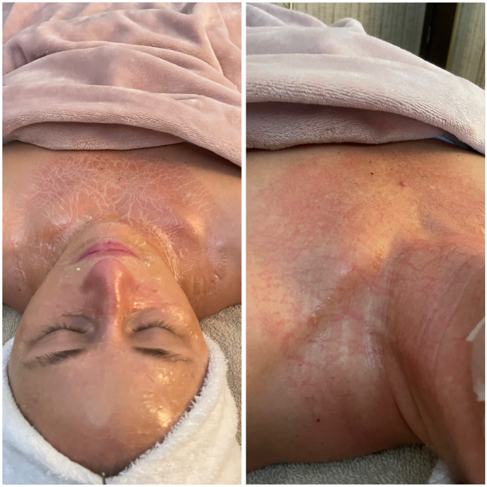The Signature Lift & Renew Facial | at Studio Glow Esthetics By Ashten in Coshocton, OH